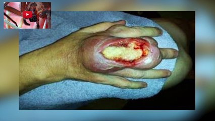 6 Most Venomous Spiders in the World