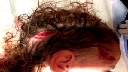 North America's 10 Deadliest Animals