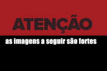 Acidente de mota  - Imagens fortes !!