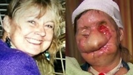 KORKUNÇ ŞEMPANZE SALDIRISI - Evcil Şempanze! Bu Hale Getirdi