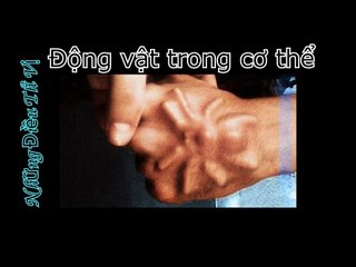 Những thứ lấy ra từ cơ thể người - Những Điều Thú Vị