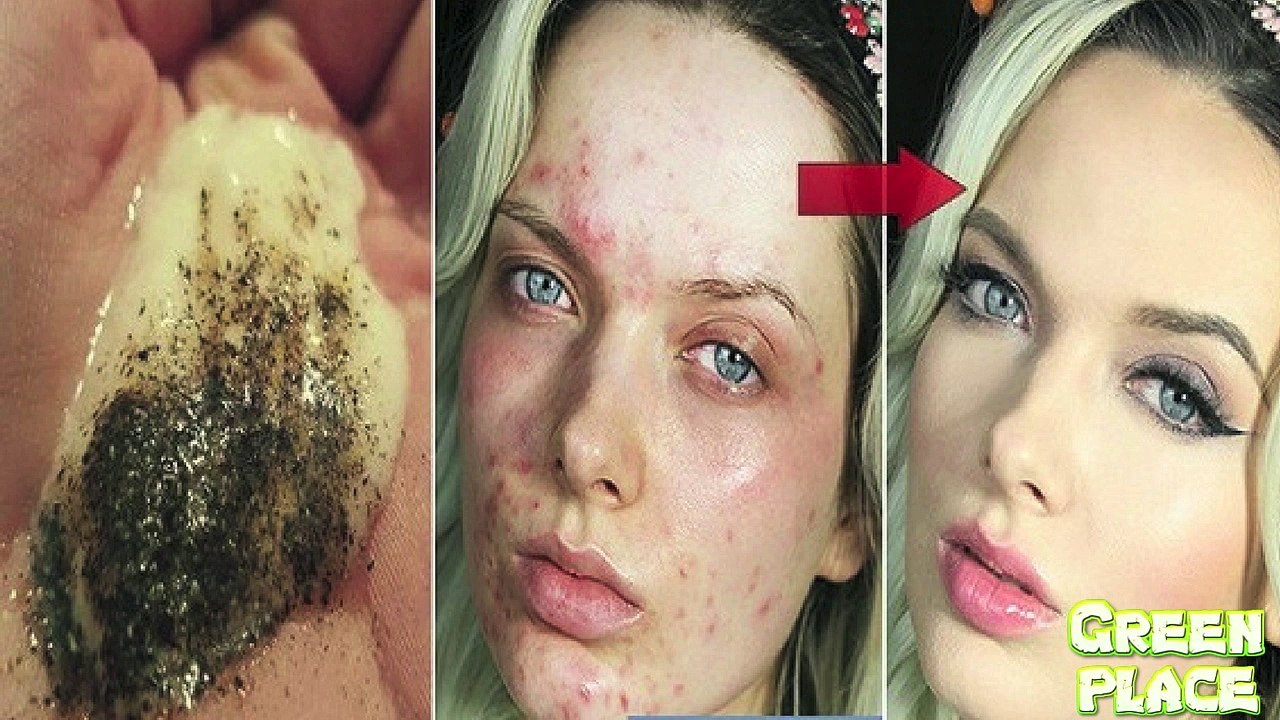 MIX THESE 2 INGREDIENTS AND SEE WHAT HAPPENS TO YOUR SKIN AFTER SEVERAL MINUTES!!