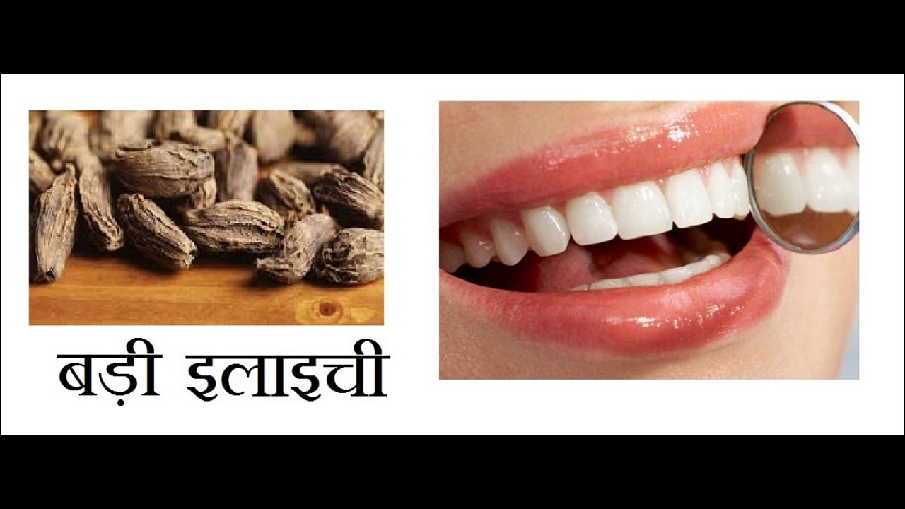 दातों के दर्द के लिये रामबाण घरेलू उपचार @Desiupchar