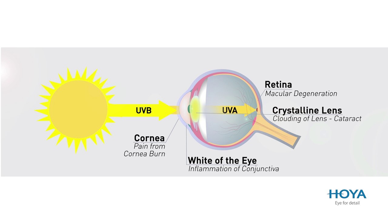 HOYA - Eye For Detail