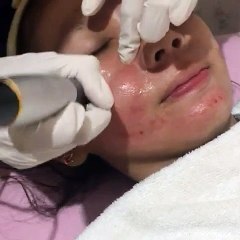 0811 1721 280, Biar Kulit Kencang di Jakarta Selatan Rinanda  Skin Care Center