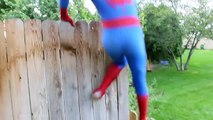 Spiderman vs Black Spiderman - Real Life Superhero Battle _ Boxing Fight-E7o