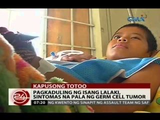 24 Oras: Pagkaduling ng isang lalaki, sintomas na pala ng tumor sa kanyang utak