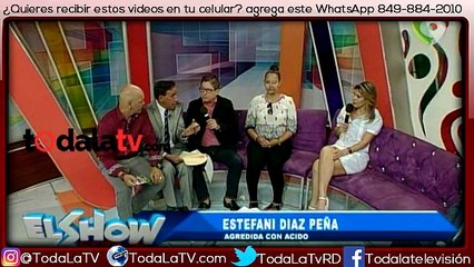Estefaní Díaz agredida con ácido Mira el antes y el después-El Show Del Mediodía-Video