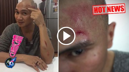 Hot News! Kecelakaan Motor, Kondisi Anji Sangat Mengejutkan - Cumicam 07 April 2017