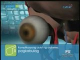 Complications caused by diabetes | Pinoy MD