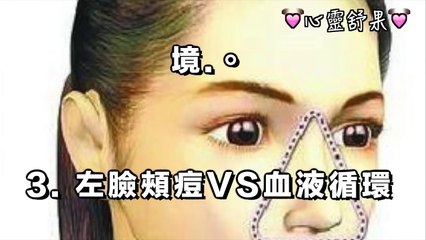 痘痘位置 告訴你身體哪裡生病了~  太有用了！ 趕快收藏吧！