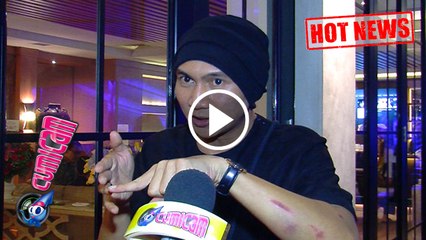 Hot News! Anji Luka Berdarah, Anak-anak Ketakutan - Cumicam 08 April 2017