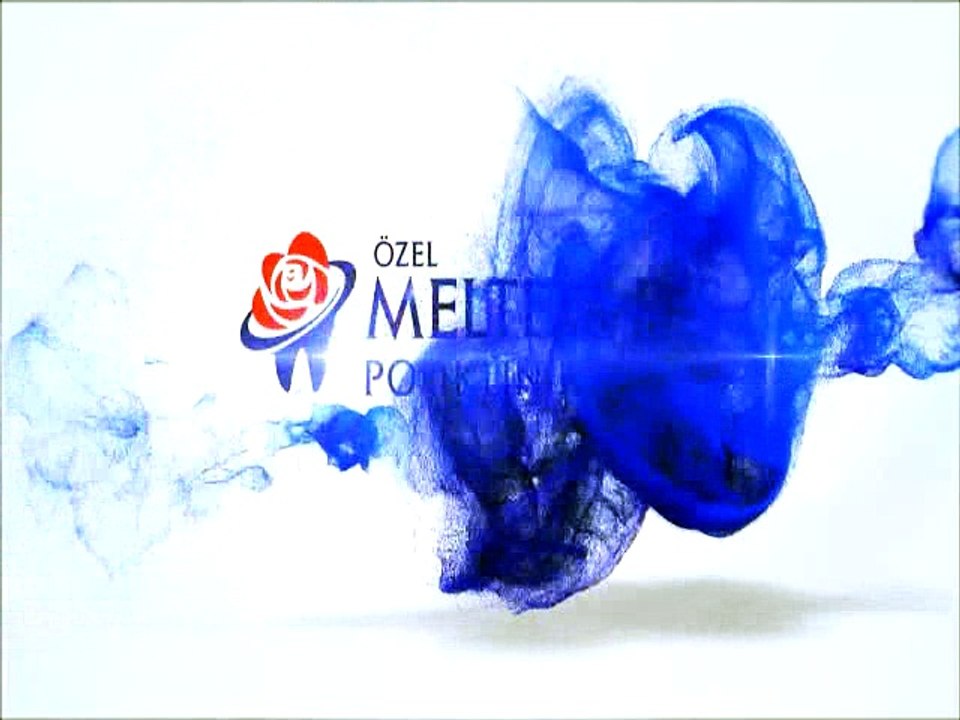 İmplant Diş tedavisi nasıl yapılır?