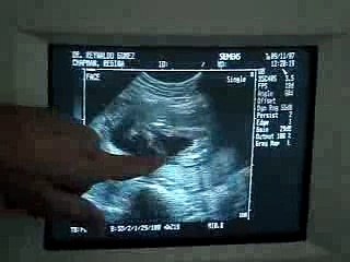 Baby - Is it a Boy or Girl....must watch