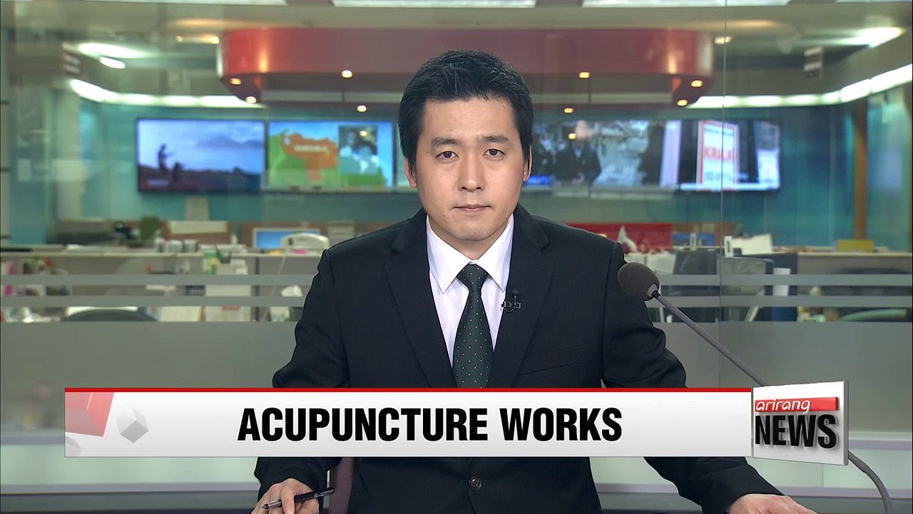 Acupuncture proves effective in treating carpal tunnel syndrome