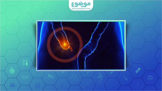 #موضوع: أسباب التهاب الزائدة الدودية
