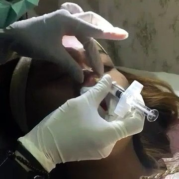 0811 1721 280, Agar hidung mancung dekat Tebet Rinanda Skin Care Center