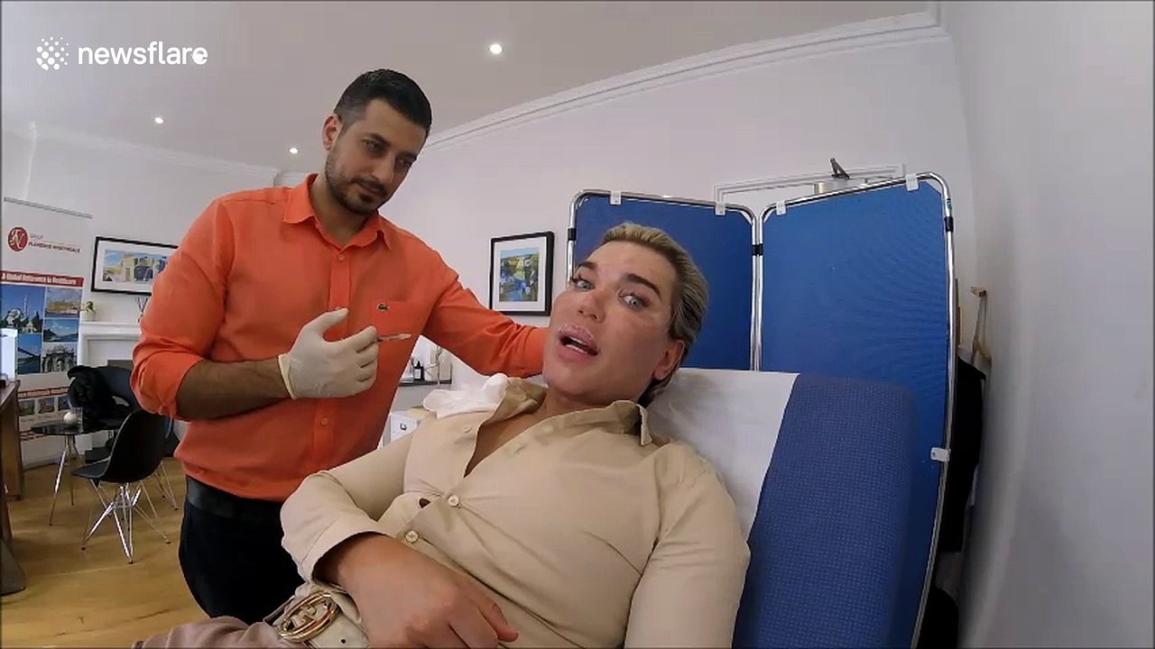 Rodrigo Alves receives botox and filler at Dr Deniz Kanliada's practice