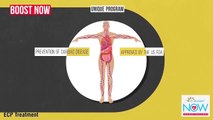 ECP Treatment (External Counterpulsation) - similar to EECP Treatment