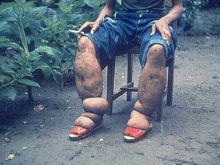 Top 10 Strange Medical Conditions That Can't Explain