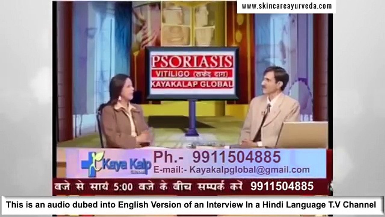 Ayurvedic Treatment for Vitiligo in India - Cure Vitiligo Naturally in India