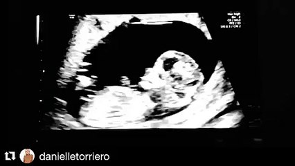 Talan Torriero: 'Laguna Beach' Star Expecting 1st Child -- See Adorable Ultrasound Video