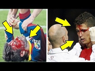 أخطر الإصابات التي تعارض لها ميسي و رونالدو