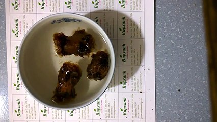 Hạt đười ươi, cách chữa sỏi thận từ hạt đười ươi