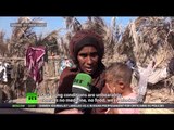 Hungry for peace: Inside Yemeni village dying from starvation (Disturbing footage)