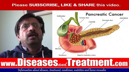 Cancer Of The Pancreas (Pancreatic Cancer) : Causes, Symptoms, Diagnosis, Treatment, Prevention