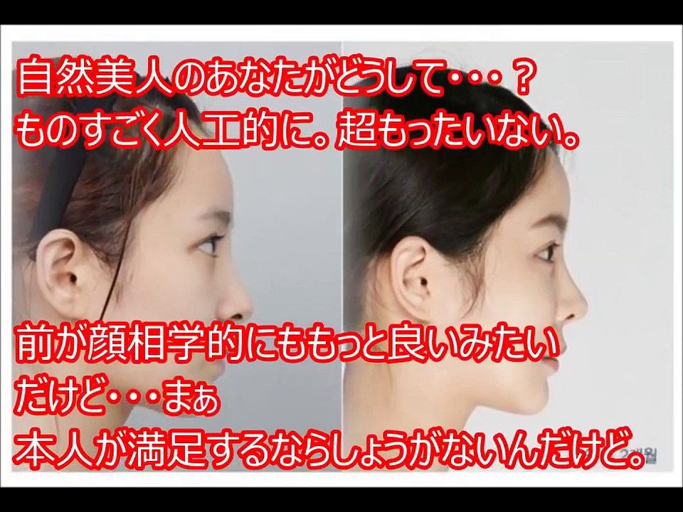 【衝撃】もったいない！自然美人が整形手術を受けた結果･･･　衝撃ビフォーアフター