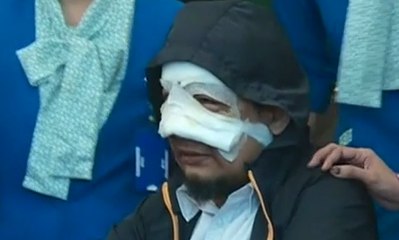 Kasus Teror Novel Baswedan, 15 Saksi Telah Diperiksa