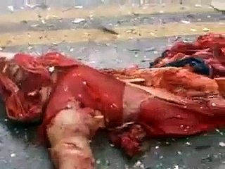 OMG BOMB gone off on a bus VERY GRAPHIC