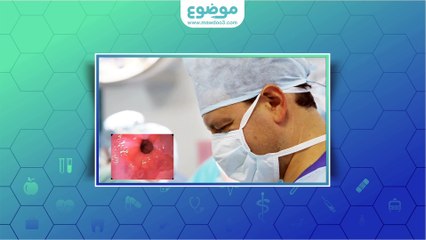 #موضوع: كيف يتم تشخيص #الإرتجاع_المريئي؟