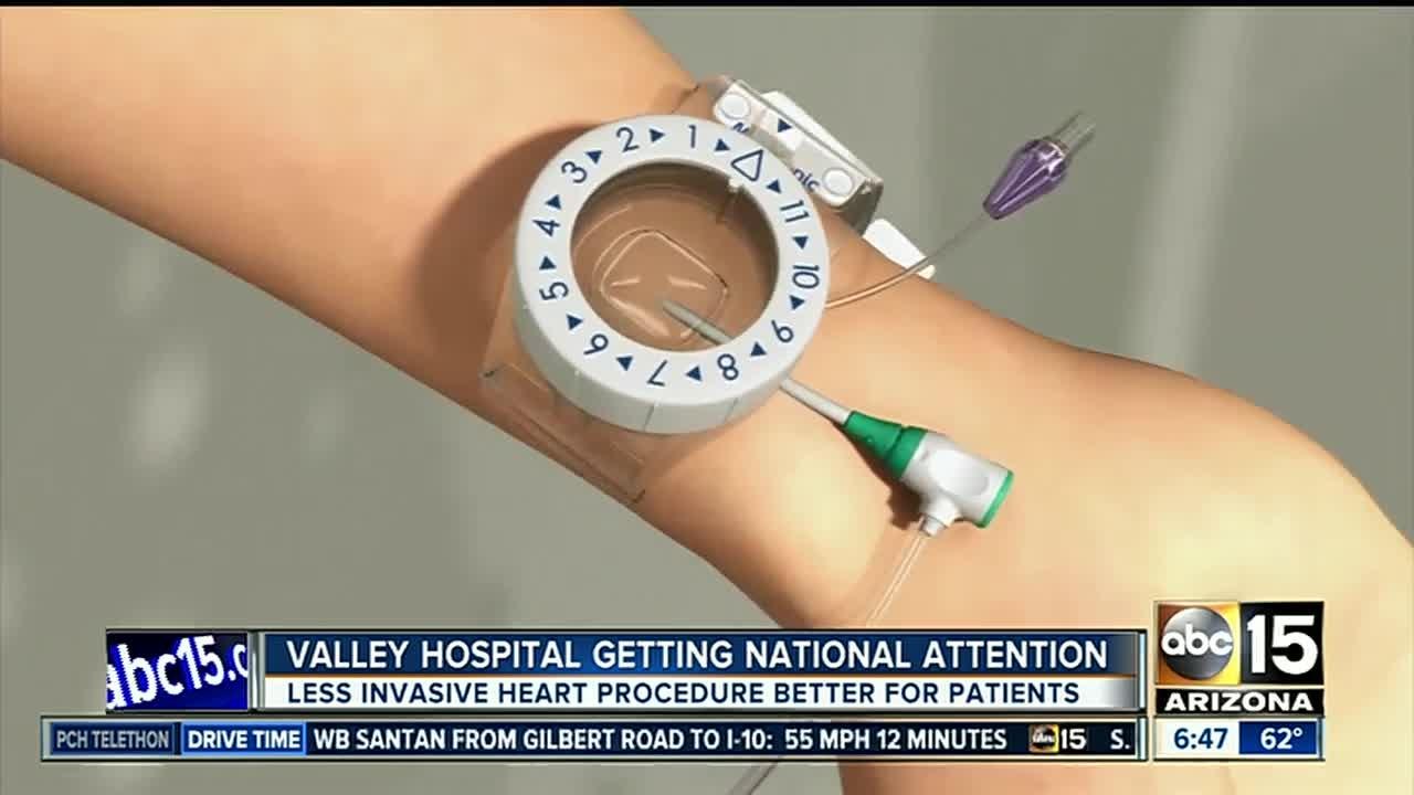 Valley hospital getting national attention for less-invasive heart procedure