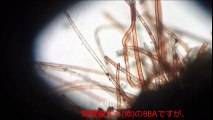 【水槽32】①海外のBBA対策②顕微鏡でBBAの遷移を観察した【もりぞう】black-beard-algae succession