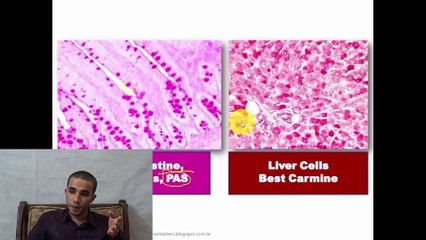 Cytoplasmic inclusions