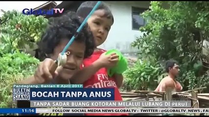 Malu, Bocah Tanpa Anus Putus Sekolah