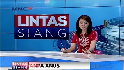 Remaja Tanpa Anus Berhenti Sekolah Karena Diejek Teman