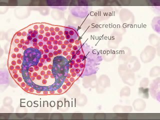 "Immune" Documentary - Part 5 - Dendritic Cells & Macrophages http://BestDramaTv.Net