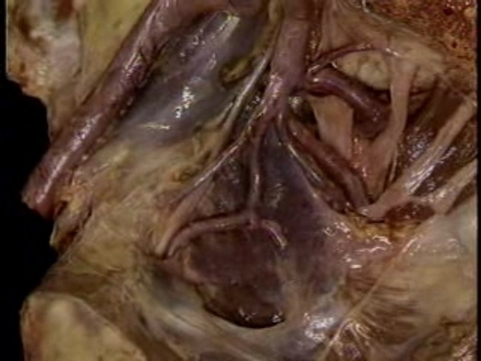 Pelvis: Blood vessels