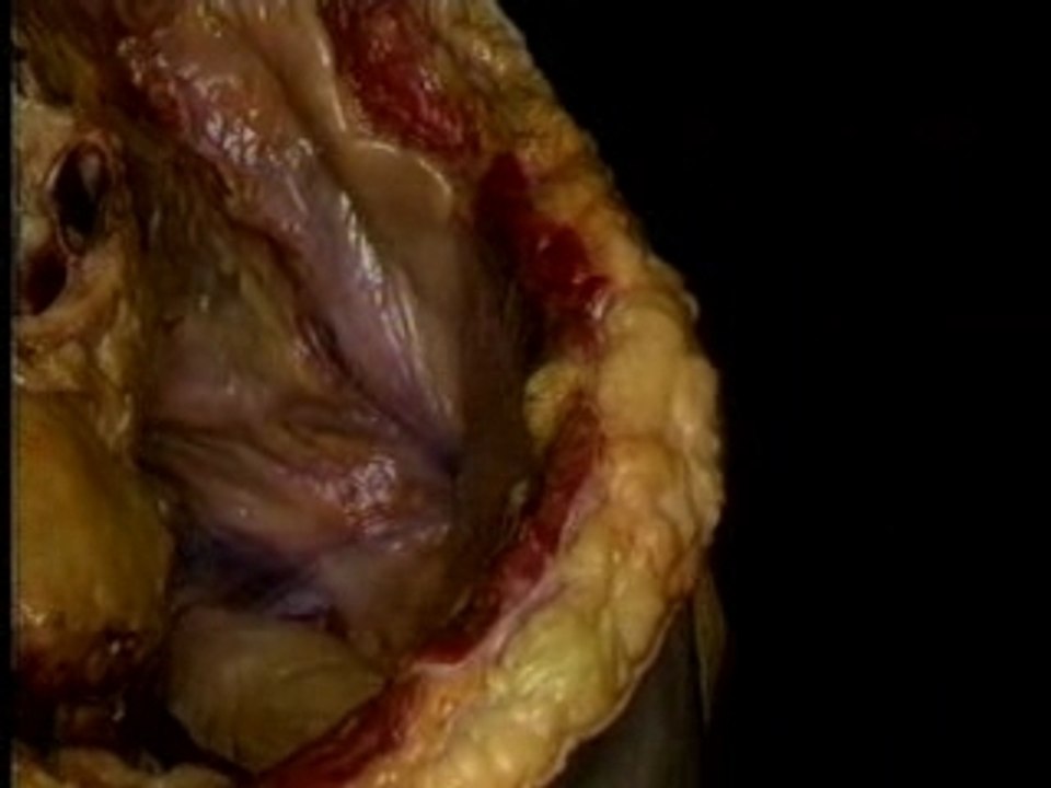 Male Reproductive System-2