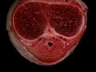 Male Reproductive System-3