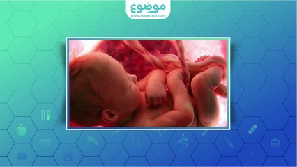 Download Video: #موضوع: الخصية الهاجرة