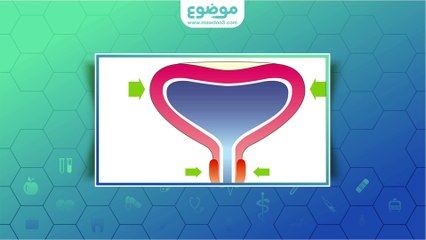 #موضوع: أنواع سلس البول