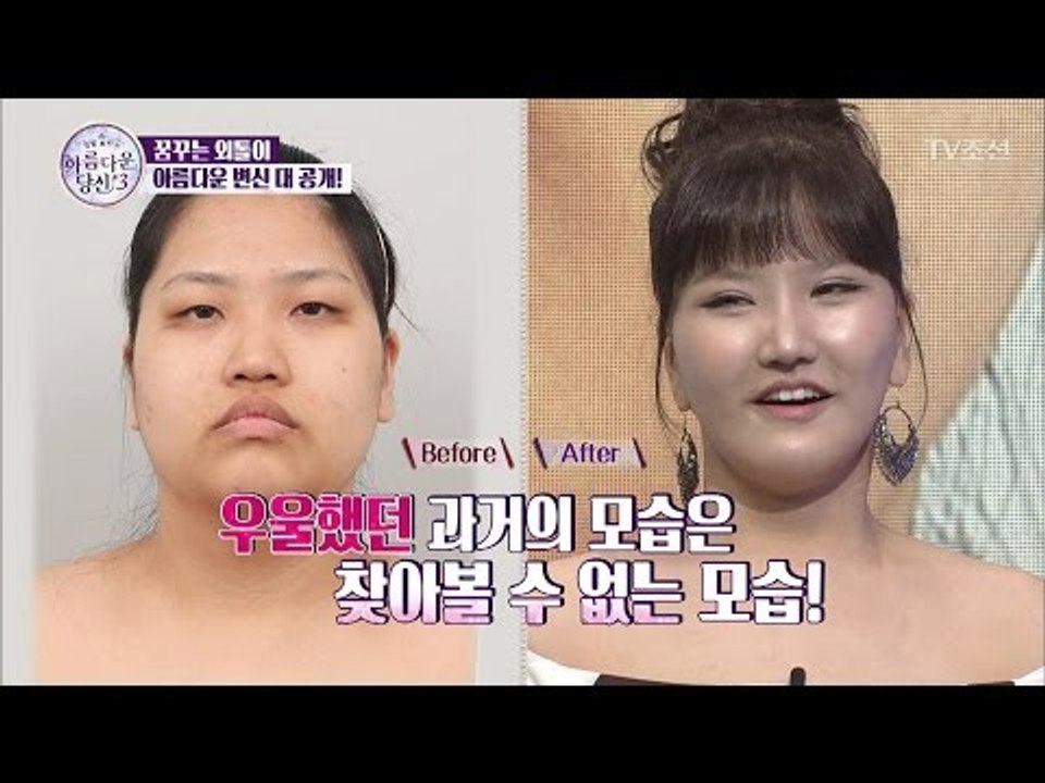밝은 모습을 되찾은 그녀! 아름다운 변신 대공개! [아름다운 당신 시즌3] 5회 20170414