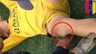 video menunjukkan cara membenarkan tempurung lutut yang copot - Tomonews