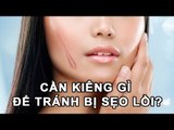 Mẹo Vặt Cuộc Sống - Bạn nên kiêng ăn gì để tránh sẹo lồi ?