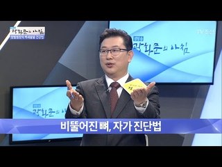 비뚤어진 뼈, 자가 진단법! [광화문의 아침] 450회 20170328