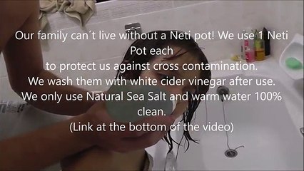 Një kohë të gjatë vogëlushja është ankuar se ka koke dhembje, por ajo çka i nxjerr babai nga hunda është e tmerrshme